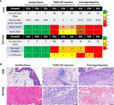 Transcriptome profiling of immune rejection mechanisms in a porcine vascularized composite allotransplantation model